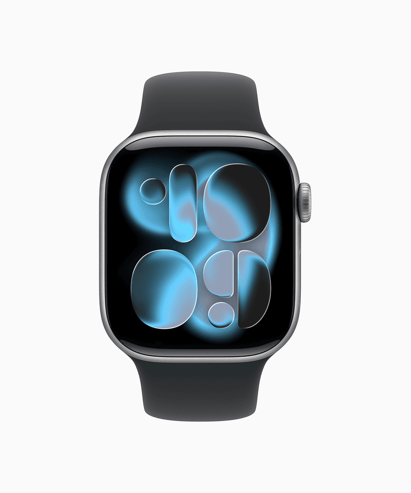 Apple Watch Series 11 1